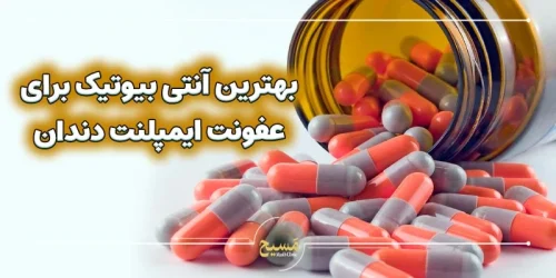 بهترین آنتی بیوتیک برای عفونت ایمپلنت دندان