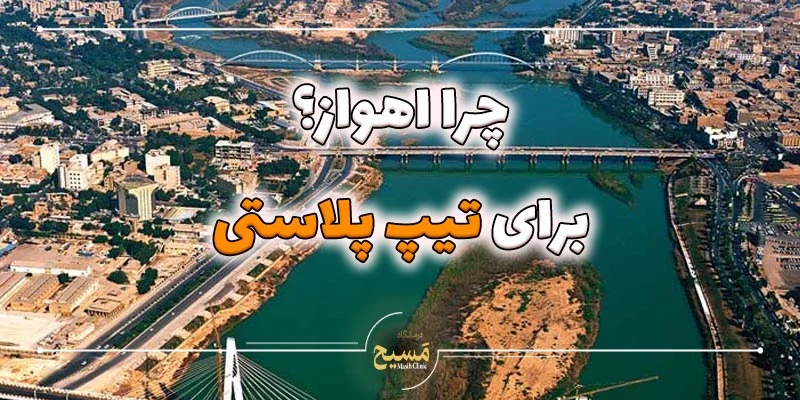 تیپ پلاستی در اهواز 12 دلایل انتخاب تیپ پلاستی در اهواز