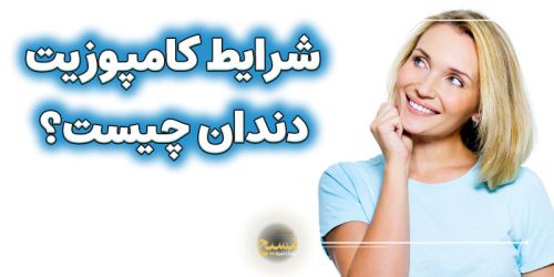 شرایط کامپوزیت دندان