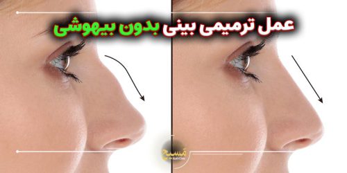 عمل ترمیمی بینی بدون بیهوشی