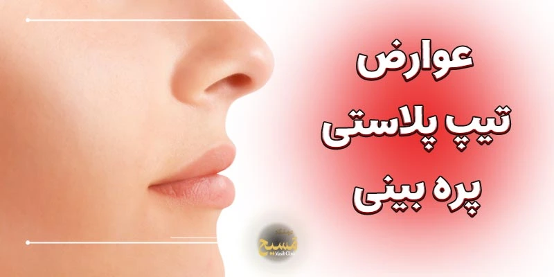 تیپ پلاستی پره های بینی 5 عوارض تیپ پلاستی پره های بینی