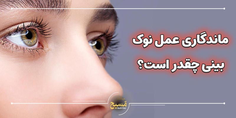 ایا میشود فقط نوک بینی را عمل کرد 1 ماندگاری عمل نوک بینی چقدر است؟