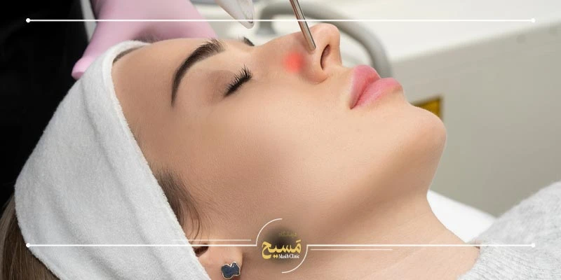 هزینه عمل بینی در بیمارستان دولتی 10 هزینه عمل بینی با لیزر در بیمارستان دولتی