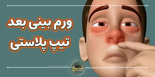 ورم بینی بعد از تیپ پلاستی