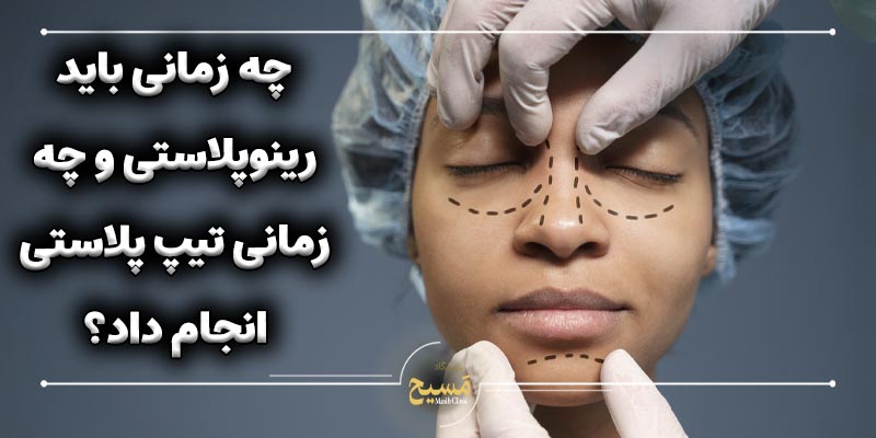 تفاوت جراحی تیپ پلاستی با رینوپلاستی 6 چه زمانی باید رینوپلاستی و چه زمانی تیپ پلاستی انجام داد؟