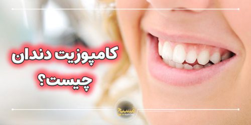 کامپوزیت دندان