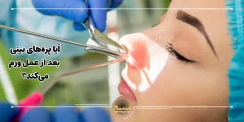 آیا پره های بینی بعد از عمل ورم می کند