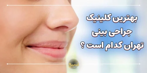 بهترین کلینیک جراحی بینی در تهران