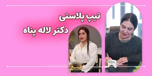 تیپ پلاستی دکتر لاله پناه