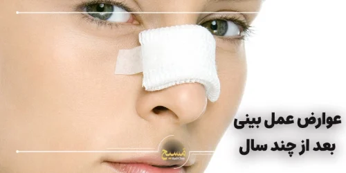 عوارض جراحی بینی بعد از چند سال