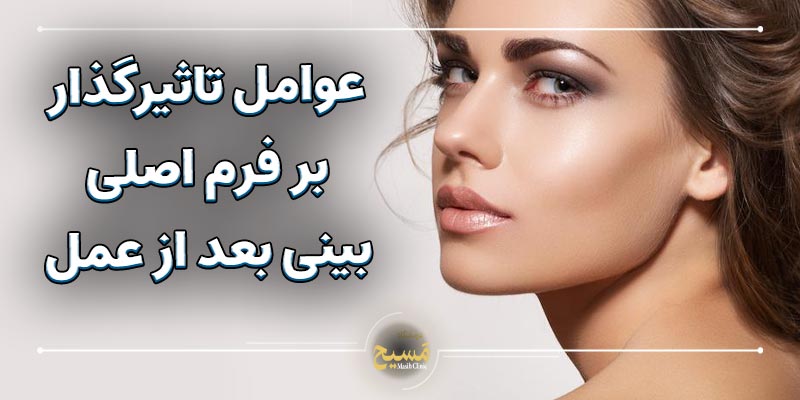 فرم اصلی بینی بعد از عمل کی مشخص میشود 6 عوامل تاثیرگذار بر فرم اصلی بینی بعد از عمل
