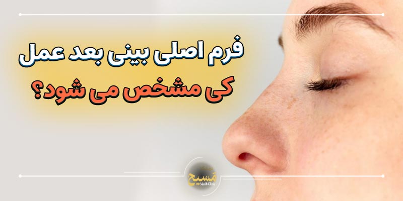 فرم اصلی بینی بعد از عمل کی مشخص میشود 1 فرم اصلی بینی بعد از عمل کی مشخص می شود؟