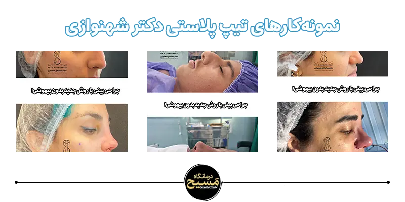 تیپ پلاستی دکتر شهنوازی 9 نمونه کارهای دکتر شهنوازی تیپ پلاستی