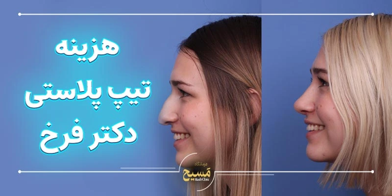 تیپ پلاستی دکتر زینب فرخ 5 هزینه تیپ پلاستی دکتر زینب فرخ