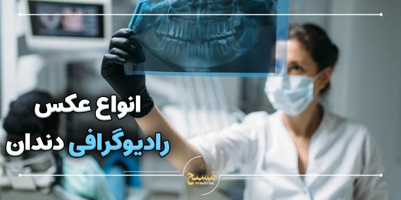 نحوه گرفتن عکس رادیوگرافی دندان 2 انواع عکس رادیوگرافی دندان