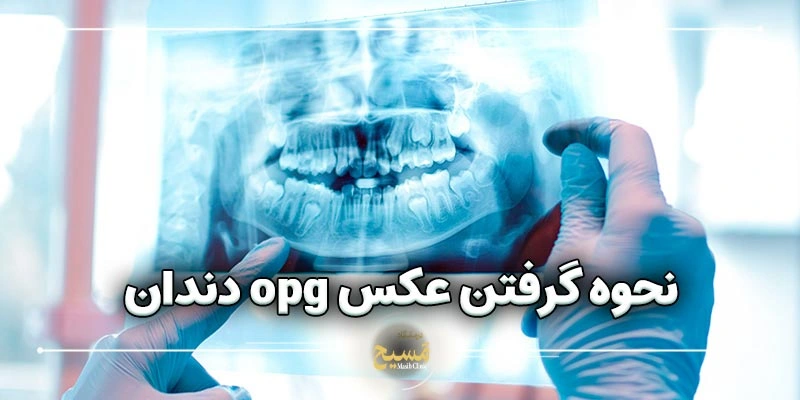 نحوه گرفتن عکس رادیوگرافی دندان 1 نحوه گرفتن عکس opg دندان