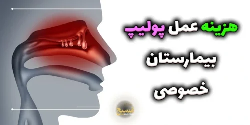 هزینه عمل پولیپ بینی در بیمارستان خصوصی