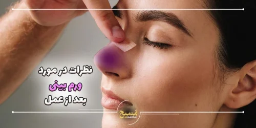 نظرات در مورد ورم بینی بعد از عمل