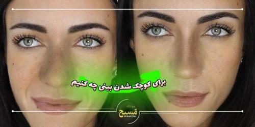 برای کوچک شدن بینی چه کنیم
