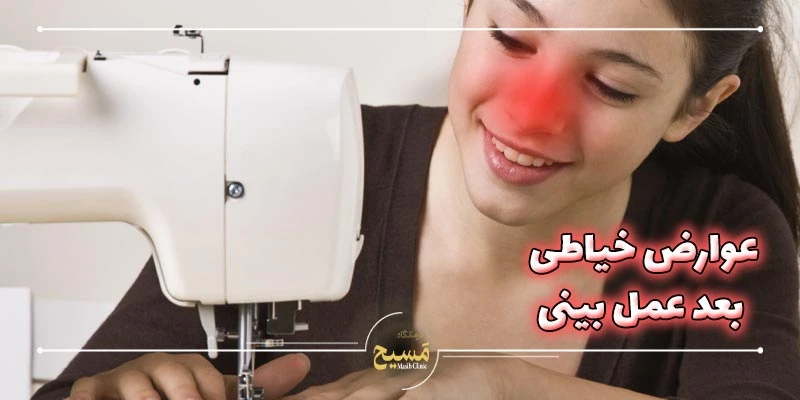 چند روز بعد از عمل بینی میتوان خیاطی کرد 1 عوارض خیاطی بعد از عمل بینی