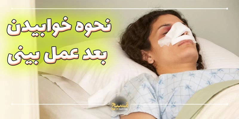 چند روز بعد از عمل بینی میتوان به پهلو خوابید 1 عکس نحوه خوابیدن بعد از عمل بینی