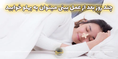 چند روز بعد از عمل بینی میتوان به پهلو خوابید