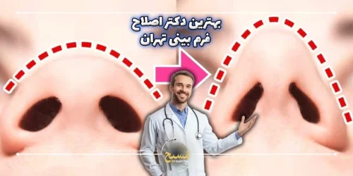 بهترین دکتر اصلاح فرم بینی در تهران