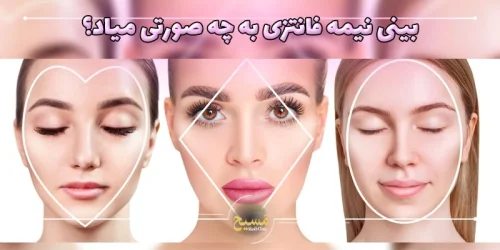 بینی نیمه فانتزی به چه صورتی میاد؟