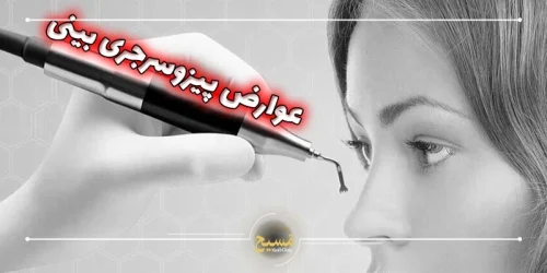 عوارض عمل بینی با دستگاه پیزوسرجری