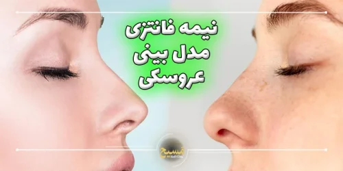 نیمه فانتزی مدل بینی عروسکی