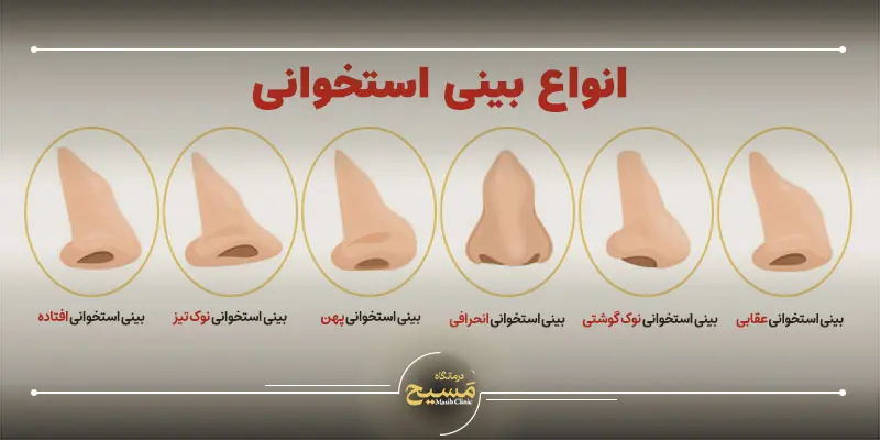 انواع عمل بینی استخوانی 1 انواع بینی استخوانی