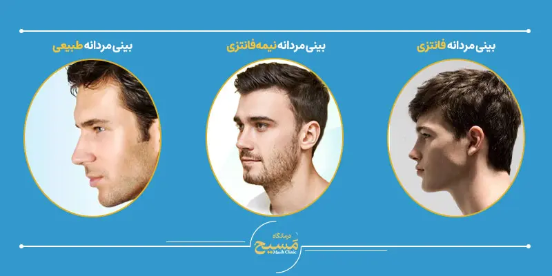 انواع مدل بینی برای عمل بینی مردانه 1 انواع مدل بینی عمل مردانه