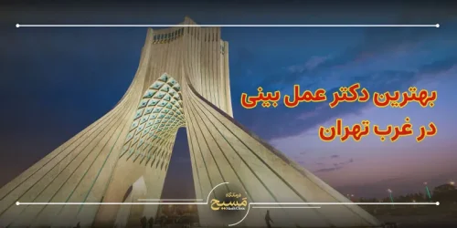 بهترین دکتر عمل بینی غرب تهران