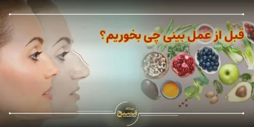 قبل از عمل بینی چی بخوریم؟