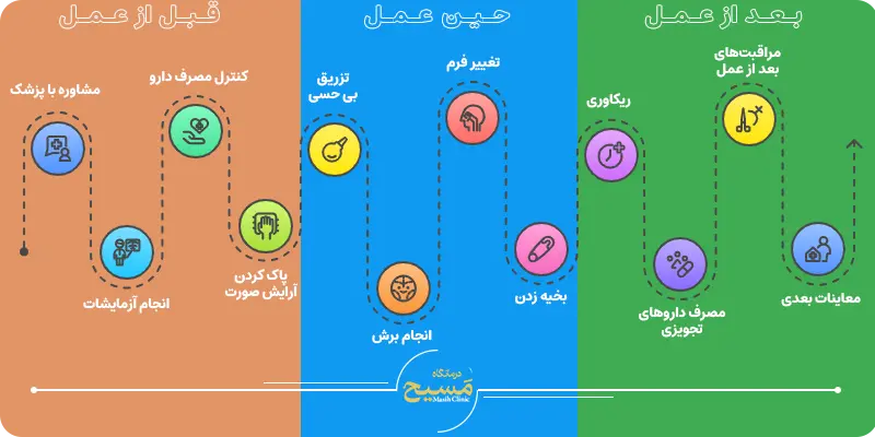 عمل بینی بدون بیهوشی 3 مراحل جراحی بینی بدون بیهوشی