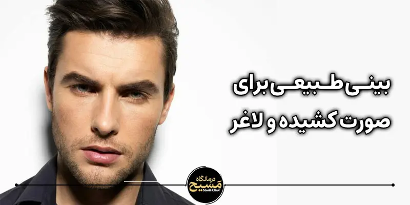 مدل بینی برای صورت کشیده و لاغر 7 بینی طبیعی برای صورت کشیده و لاغر