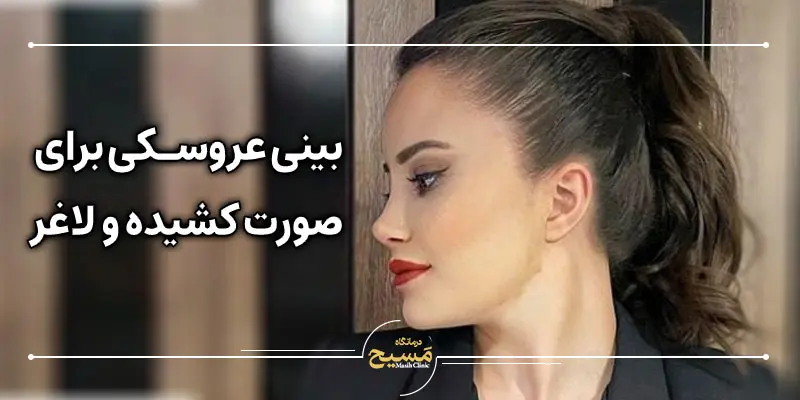 مدل بینی برای صورت کشیده و لاغر 5 بینی عروسکی برای صورت کشیده و لاغر