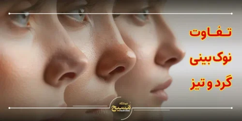 تفاوت نوک بینی گرد و تیز