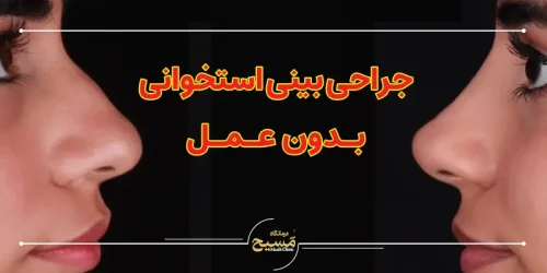 جراحی بینی استخوانی بدون عمل