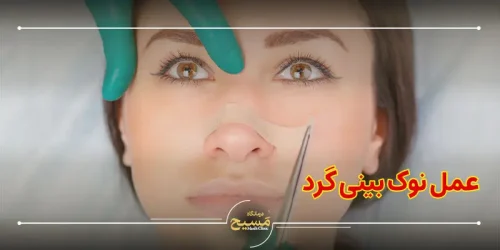 عمل نوک بینی گرد
