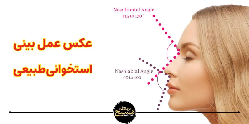 بهترین مدل عمل بینی استخوانی 6 عکس عمل بینی استخوانی طبیعی