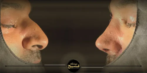 نمونه کار تیپ پلاستی درمانگاه مسیح