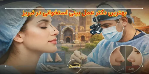 بهترین دکتر عمل بینی استخوانی در تبریز