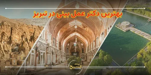 بهترین دکتر عمل بینی در تبریز