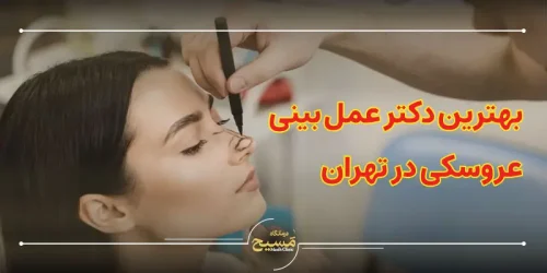 بهترین دکتر عمل بینی عروسکی در تهران