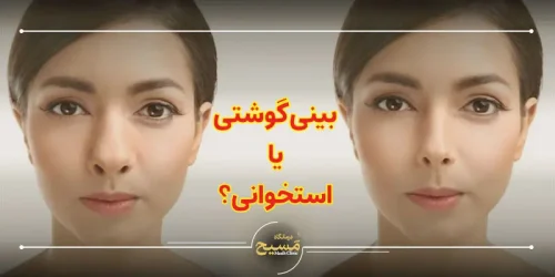 بینی گوشتی یا استخوانی
