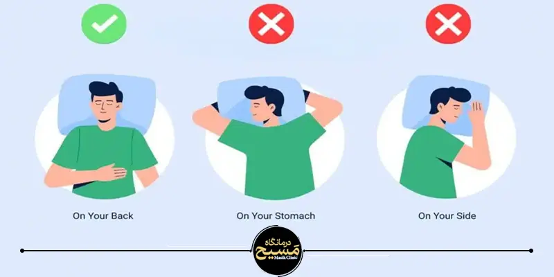 10 اشتباه خطرناک بعد از عمل بینی 4 بعد از عمل بینی به پهلو نخوابید