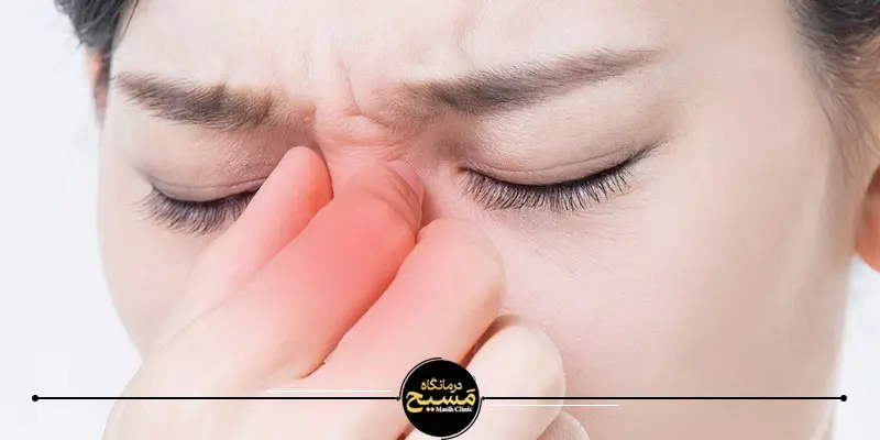 10 اشتباه خطرناک بعد از عمل بینی 5 مراقب ضربه به بینی خود باشید