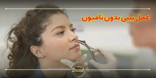 عمل بینی بدون تامپون