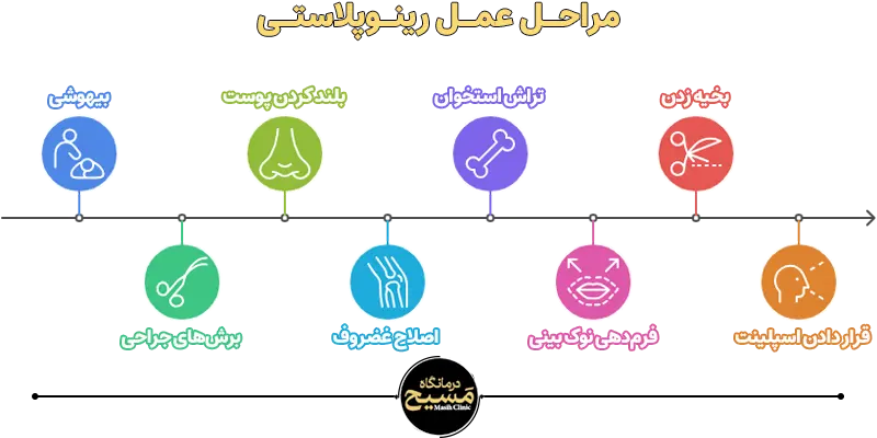 نحوه عمل رینوپلاستی 1 مراحل عمل رینوپلاستی